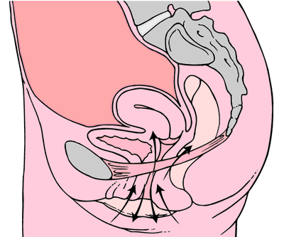 Kegel exercises